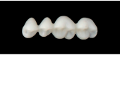 Cod.S3UPPER LEFT : 15x  posterior solid (not hollow) wax bridges, SMALL, (24-27) , with precarved occlusion to Cod.S3LOWER LEFT,and compatible to Cod.E3UPPER LEFT (hollow), (24-27)